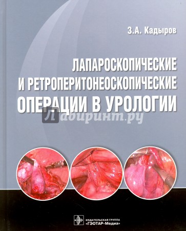 Лапароскопические и ретроперитонеоскопические операции в урологии