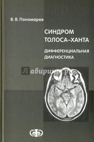 Синдром Толоса-Ханта. Дифференциальная диагностика