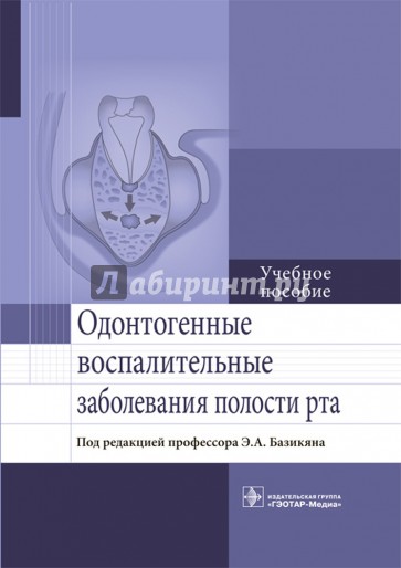 Одонтогенные воспалительные заболевания полости рта