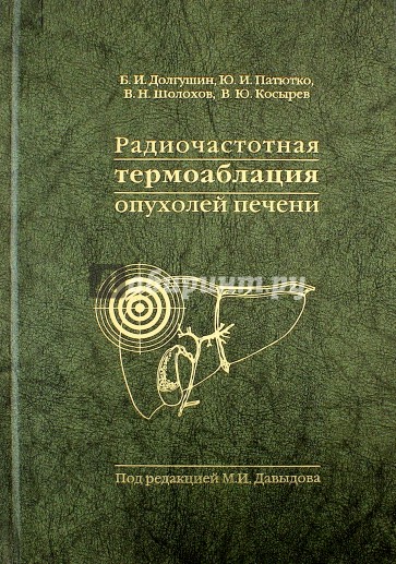 Радиочастотная термоаблация опухолей печени