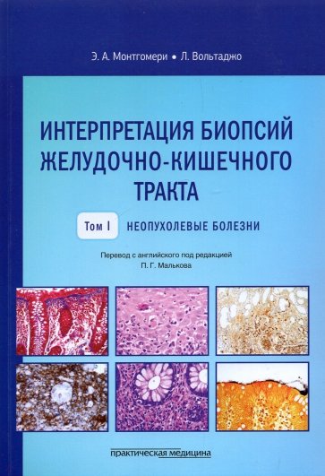 Интерпрет.биопсий желуд-киш.тракта.Т.1.Неопух.бол
