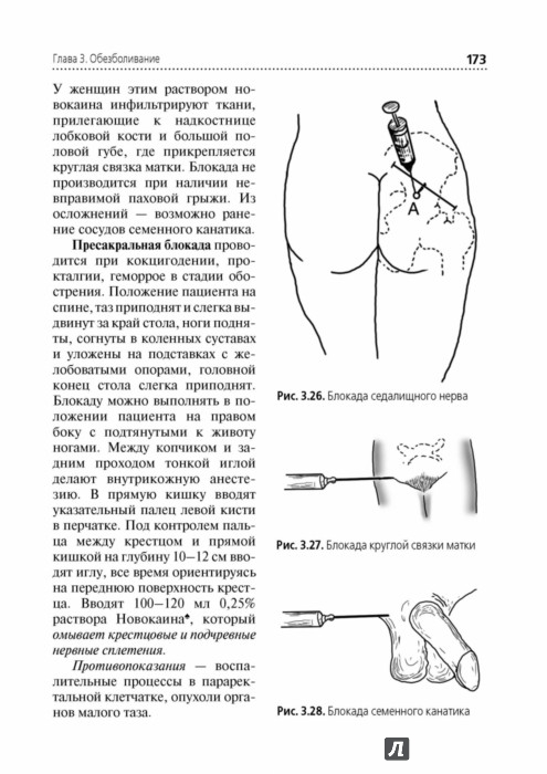 Блокада инструкция. Пресакральная блокада техника. Пресакральная блокада по Вишневскому. Пресакральная новокаиновая блокада техника. Пресакральная новокаиновая блокада показания.