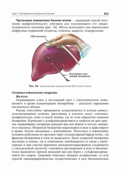 Пропедевтика внутренних. Печень пропедевтика внутренних болезней. Биопсия печени заключение. Пункционная биопсия печени заключение. Синдромы печени пропедевтика.