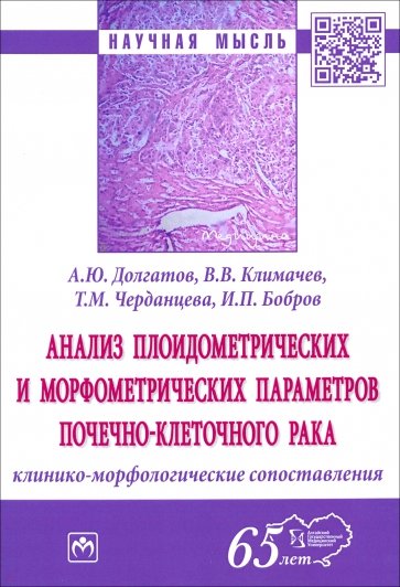 Анализ плоидометрических и морфометрических параметров почечно-клеточного рака