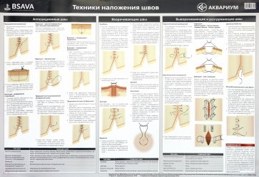 Плакат "Техника наложения швов" 84х59 см. (в тубусе)