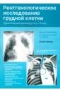 Обложка Рентгенологическое исследование грудной клетки. Практическое руководство. Атлас