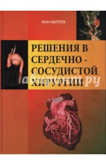 Решения в сердечно-сосудистой хирургии - Жан Митрев