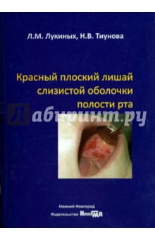 Лукиных, Тиунова - Красный плоский лишай слизистой оболочки полости рта обложка книги Лукиных, Тиунова - Красный плоский лишай слизистой оболочки полости рта обложка книги