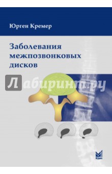 Юнгер Кремер - Заболевания межпозвонковых дисков обложка книги Юнгер Кремер - Заболевания межпозвонковых дисков обложка книги