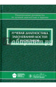 Лучевая диагностика заболеваний костей и суставов. Национальное руководство