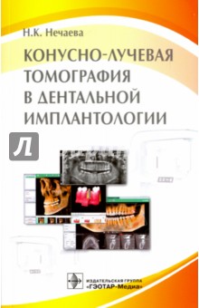 Конусно-лучевая томография в дентальной имплантологии - Наталья Нечаева
