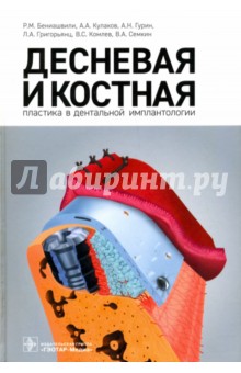 Десневая и костная пластика в дентальной имплантологии - Бениашвили, Кулаков, Гурин