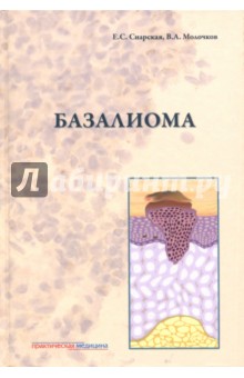 Базалиома - Снарская, Молочков