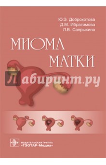 Миома матки. Руководство - Доброхотова, Ибрагимова, Сапрыкина