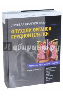 Лучевая диагностика. Опухоли органов грудной клетки