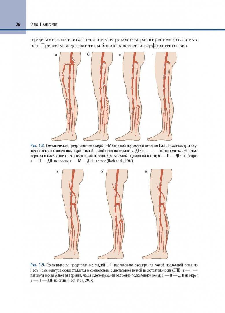 Иллюстрация 12 из 12 для Минимально инвазивное лечение варикозного расширения вен - Алм, Брой, Мауринс | Лабиринт - книги. Источник: Лабиринт