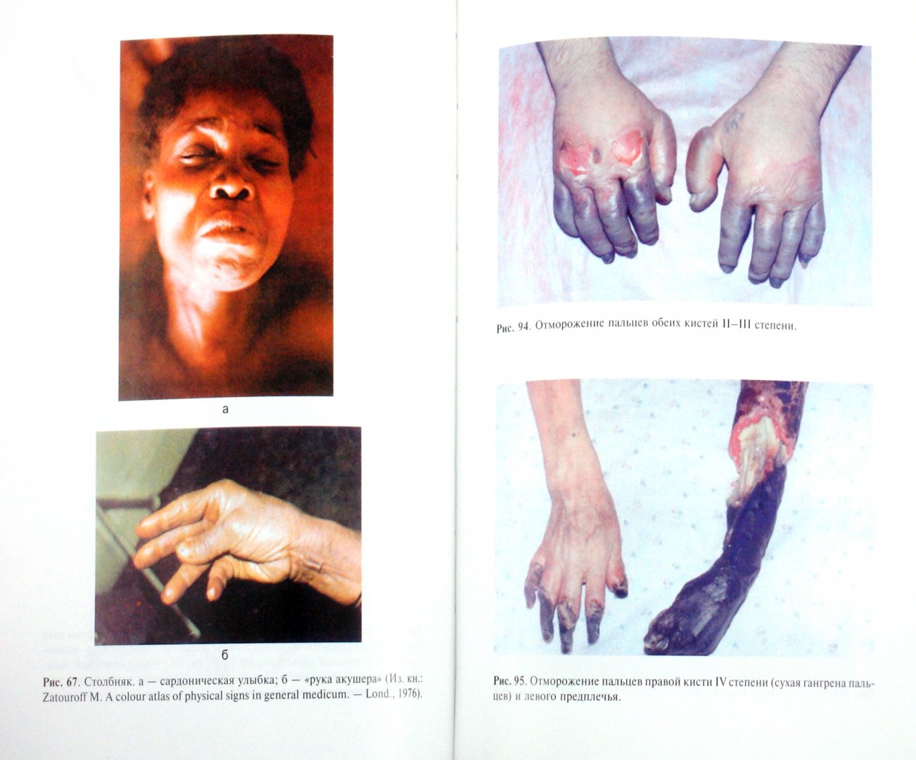 Иллюстрация 1 из 25 для Общая хирургия: учебник (+CD) - Виктор Гостищев | Лабиринт - книги. Источник: Лабиринт