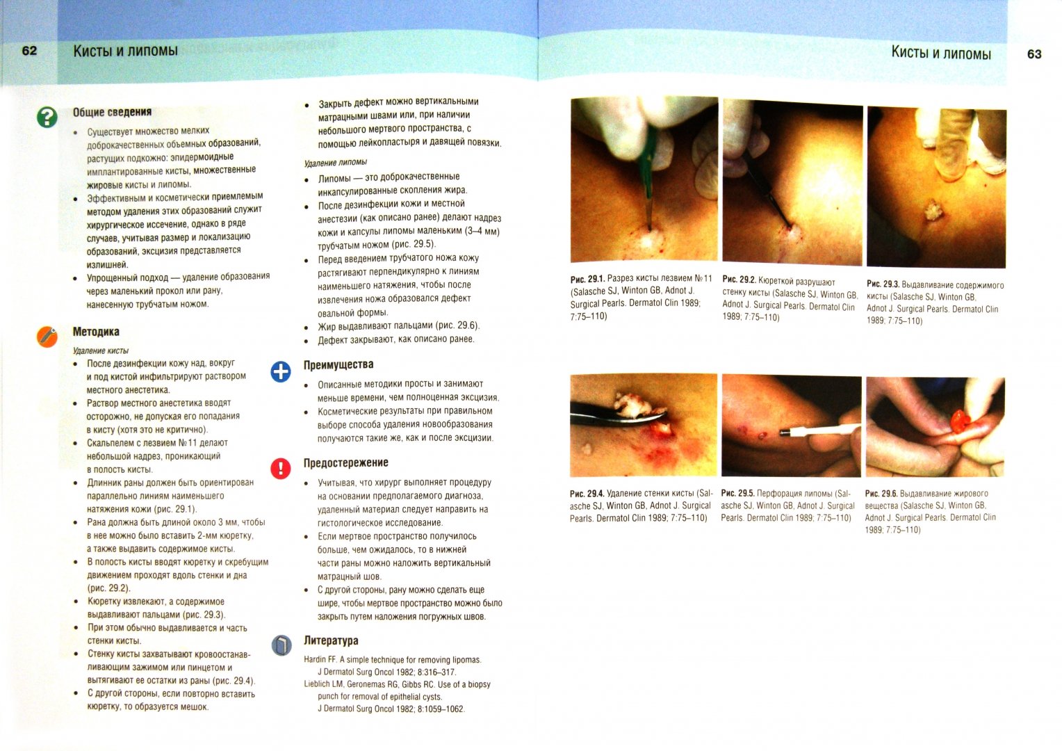 Иллюстрация 1 из 7 для Дерматохирургия. Know-How для косметологов и дерматологов - Сейласке, Оренго, Сигл | Лабиринт - книги. Источник: Лабиринт