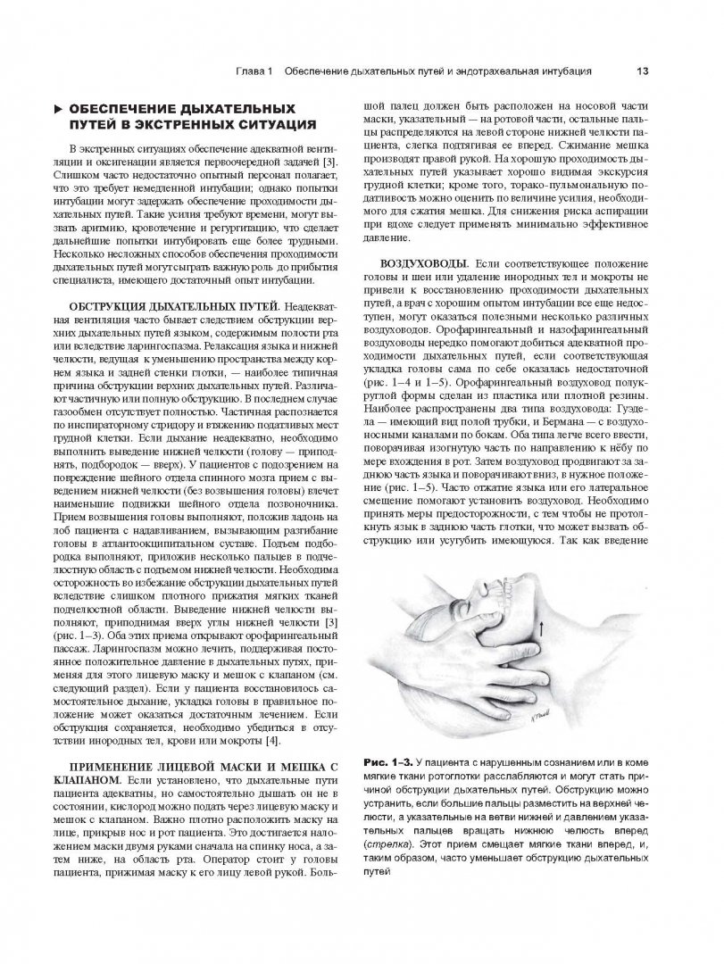 Иллюстрация 12 из 13 для Процедуры и техники в неотложной медицине - Ирвин, Риппе, Керли | Лабиринт - книги. Источник: Лабиринт