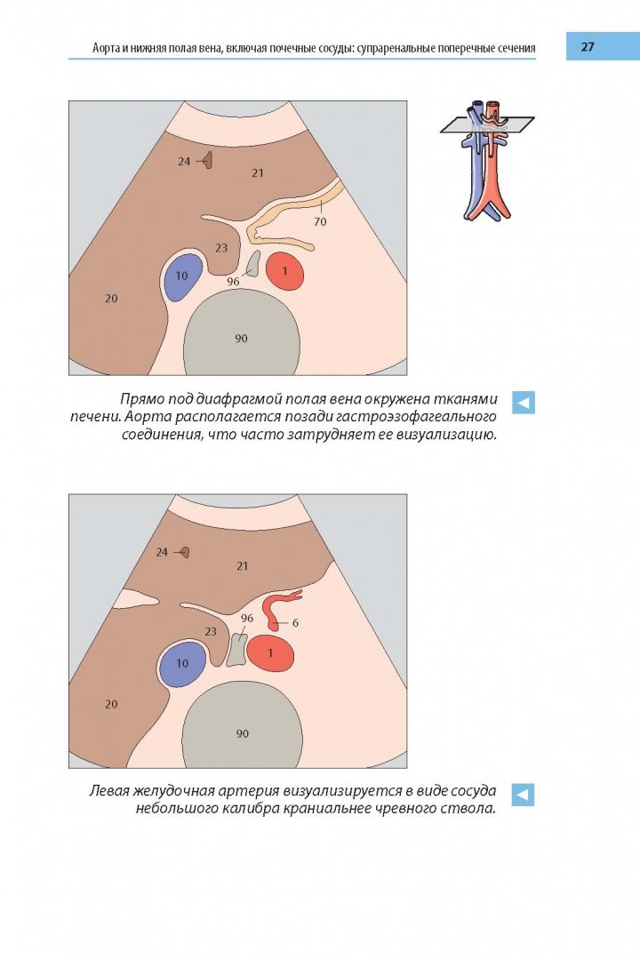 Иллюстрация 15 из 22 для Цветной атлас ультразвуковых исследований - Бертольд Блок | Лабиринт - книги. Источник: Лабиринт