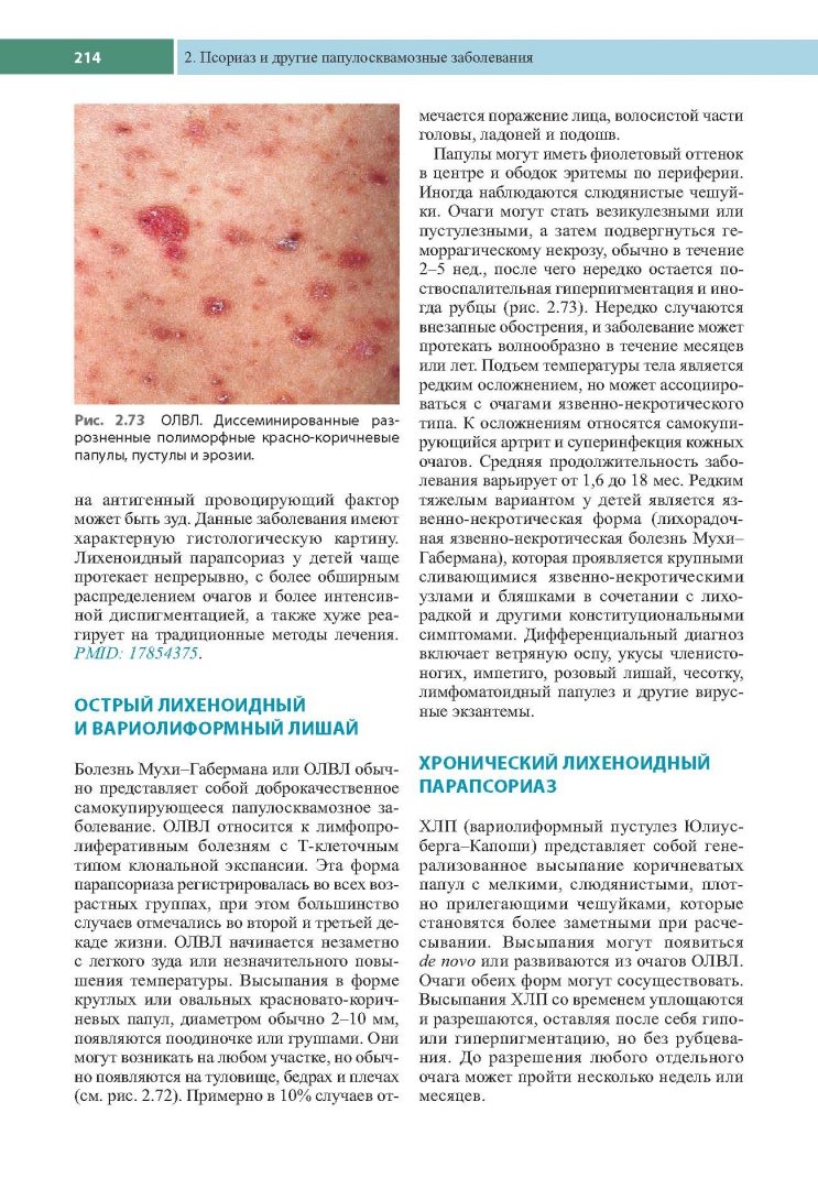 Иллюстрация 8 из 19 для Клиническая дерматология. Акнеподобные и папулосквамозные дерматозы - Томас Хэбиф | Лабиринт - книги. Источник: Лабиринт