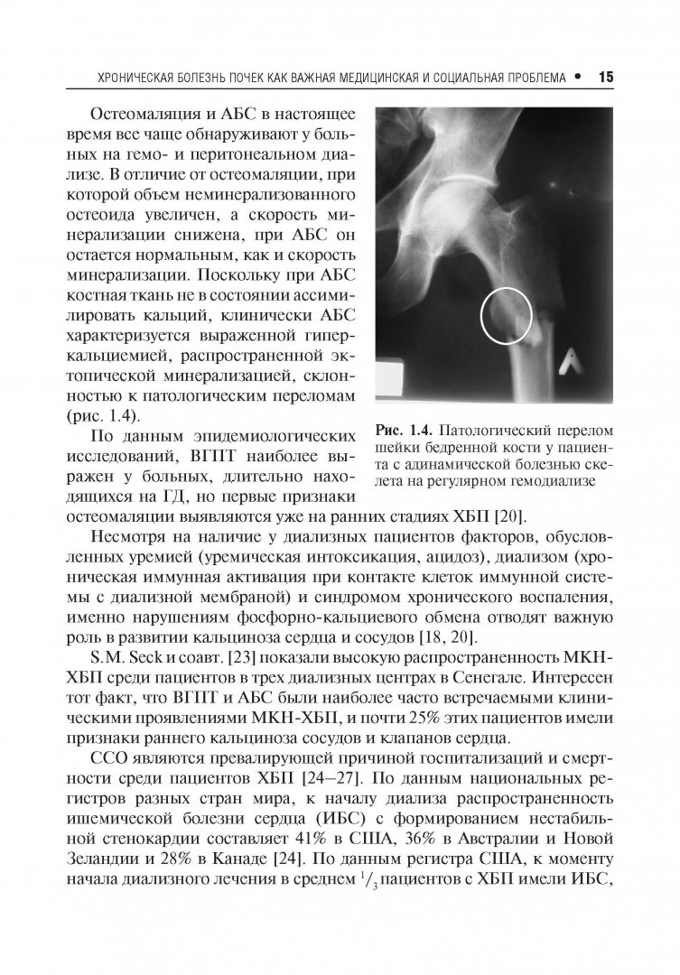 Иллюстрация 5 из 8 для Нарушения минерального и костного обмена при хронической болезни почек - Милованов, Милованова | Лабиринт - книги. Источник: Лабиринт