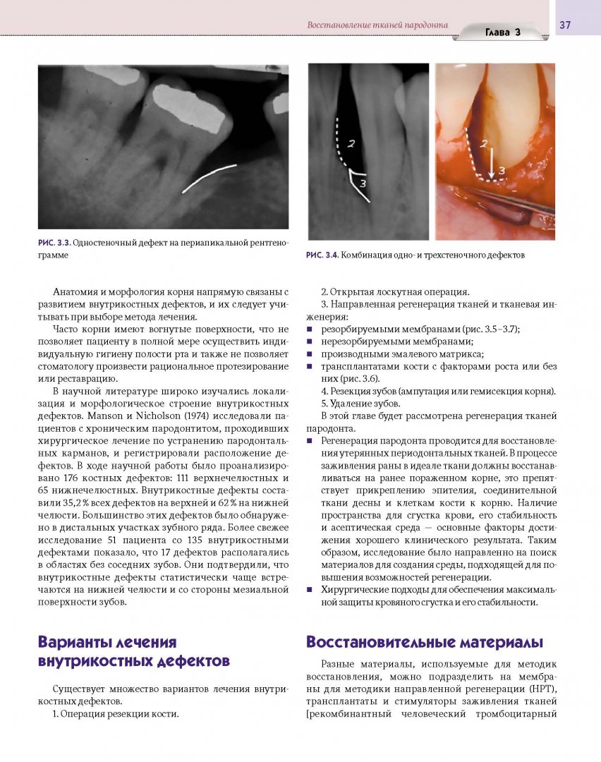 Иллюстрация 14 из 15 для Регенеративные технологии в стоматологии. Научно-практическое руководство - Барон, Нанмарк | Лабиринт - книги. Источник: Лабиринт