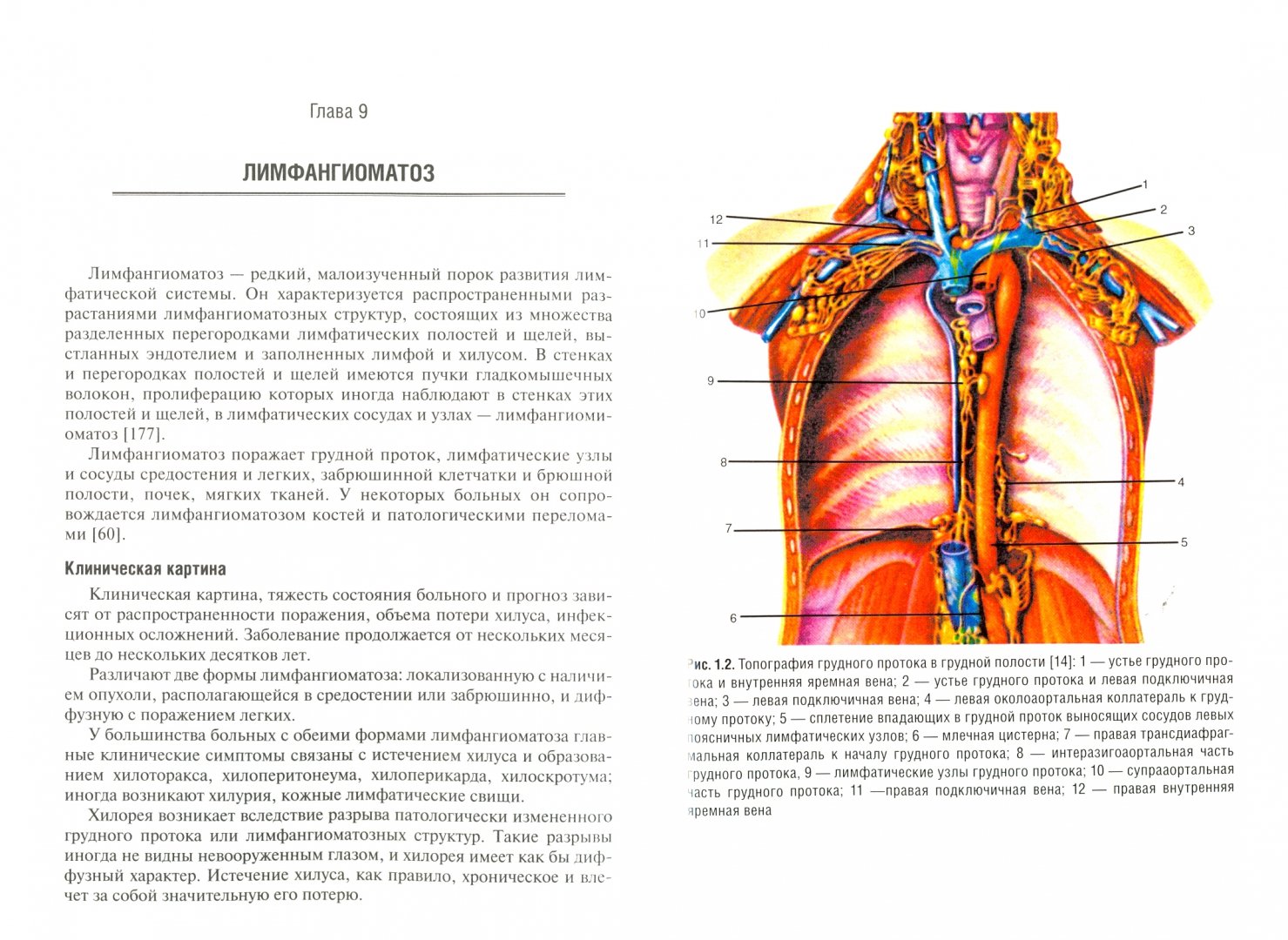 Иллюстрация 1 из 6 для Хирургия грудного протока. Монография - Паршин, Седова, Самохин | Лабиринт - книги. Источник: Лабиринт