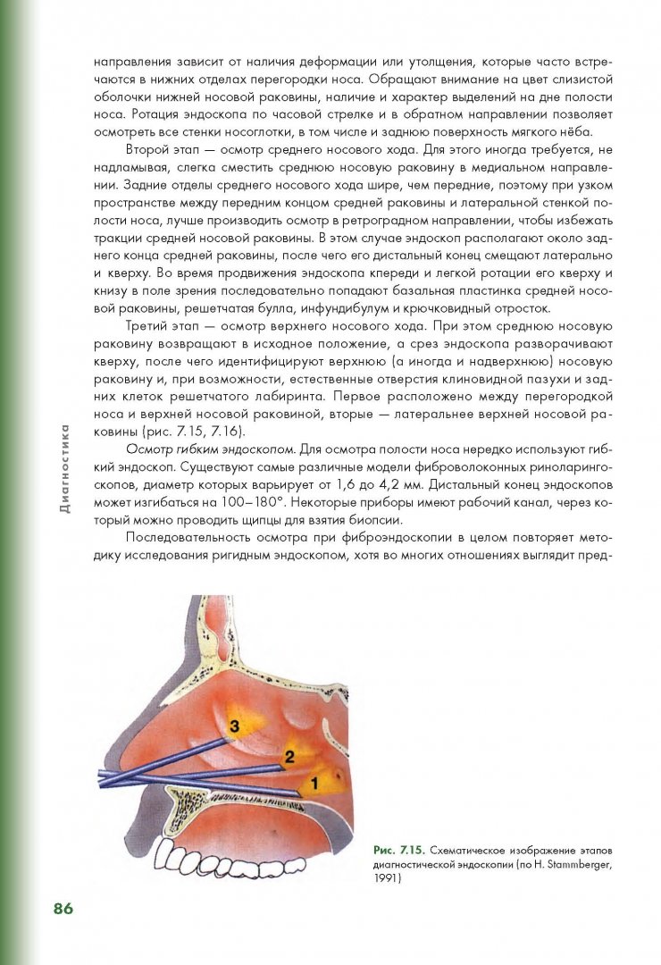 Иллюстрация 10 из 28 для Эндоскопическая диагностика и лечение назальной ликвореи - Потапов, Лопатин, Капитанов | Лабиринт - книги. Источник: Лабиринт