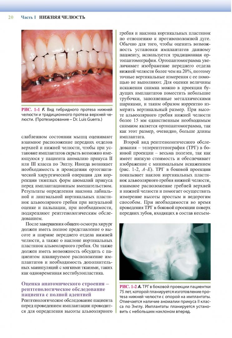 Иллюстрация 9 из 30 для Дентальная имплантология. Хирургические аспекты - Майкл Блок | Лабиринт - книги. Источник: Лабиринт