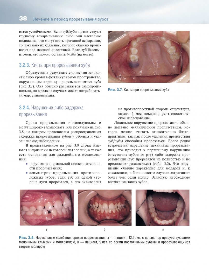 Иллюстрация 7 из 19 для Основы ортодонтии - Лаура Митчелл | Лабиринт - книги. Источник: Лабиринт