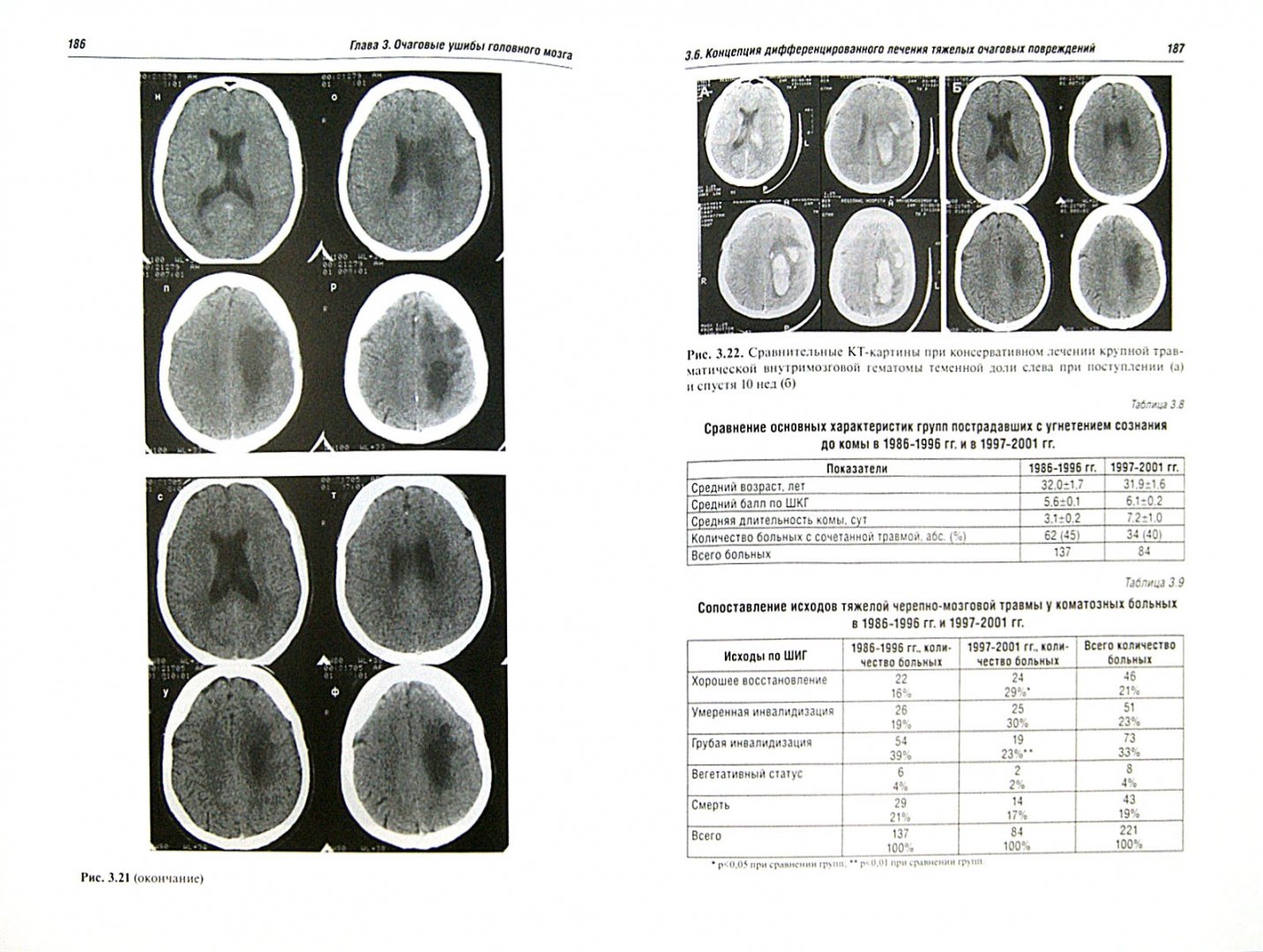 Иллюстрация 1 из 32 для Черепно-мозговая травма. Диагностика и лечение - Леонид Лихтерман | Лабиринт - книги. Источник: Лабиринт