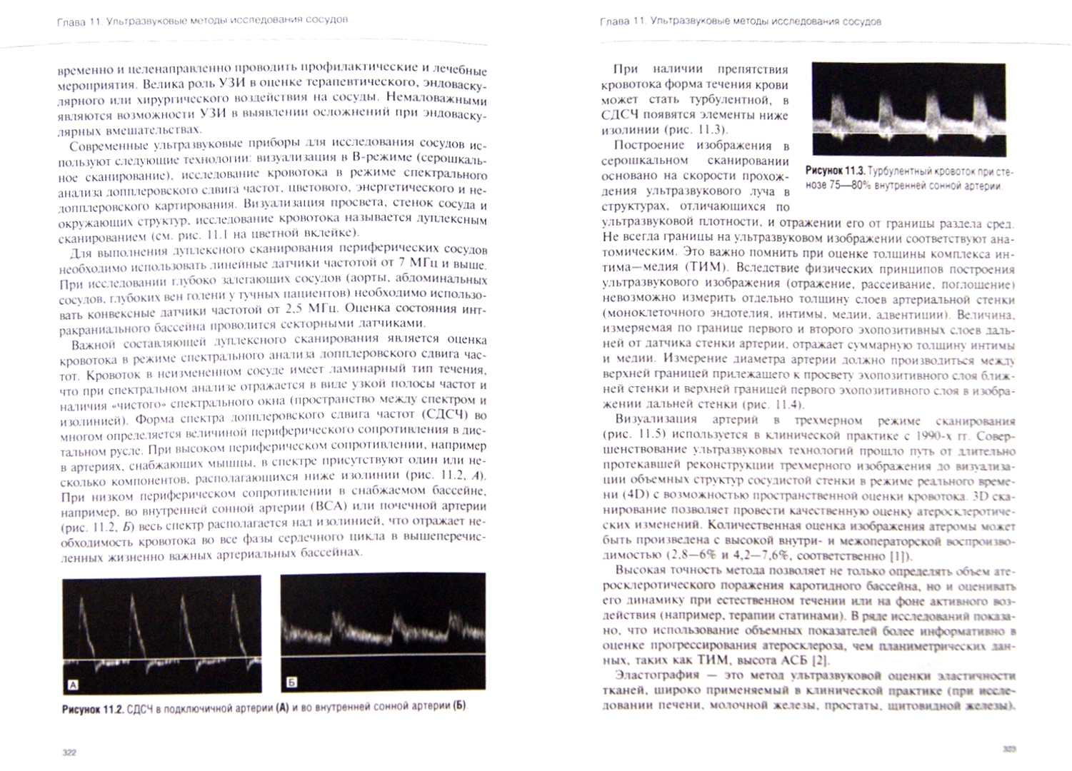 Иллюстрация 1 из 29 для Руководство по кардиологии. Том 2. Методы диагностики сердечно-сосудистых заболеваний | Лабиринт - книги. Источник: Лабиринт