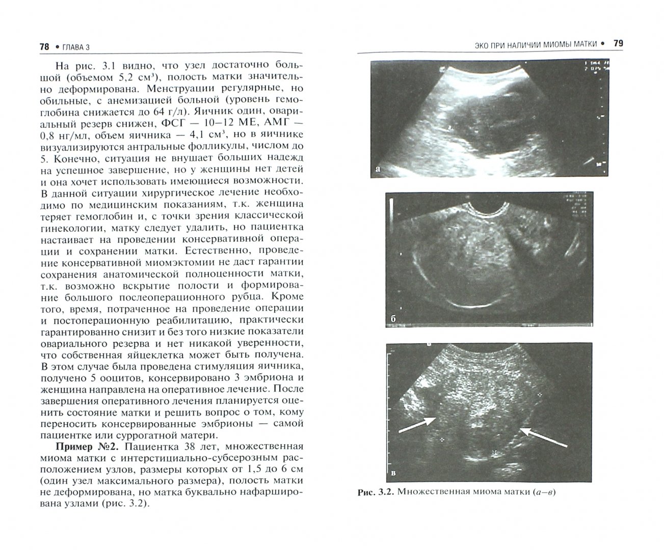 Иллюстрация 1 из 24 для ЭКО при гинекологических и эндокринных заболеваниях - Татьяна Назаренко | Лабиринт - книги. Источник: Лабиринт