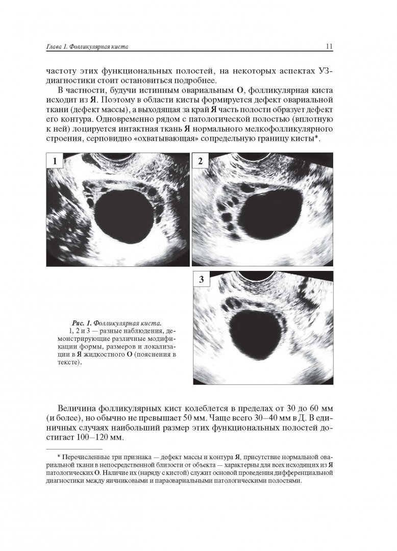 Иллюстрация 2 из 22 для Ультразвуковая симптоматика и дифференциальная диагностика кист и опухолей яичников - Сурен Хачкурузов | Лабиринт - книги. Источник: Лабиринт