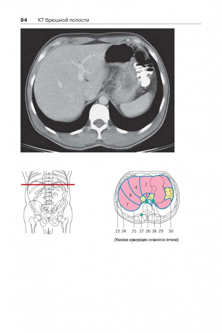 Иллюстрация 9 из 13 для Атлас секционной анатомии человека на примере КТ- и МРТ- срезов. В 3-х томах. Том 2 - Торстен Меллер | Лабиринт - книги. Источник: Лабиринт