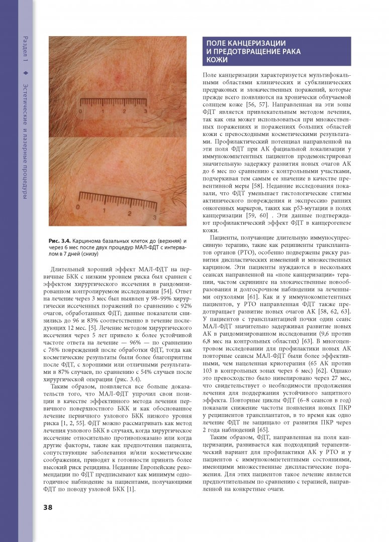 Иллюстрация 6 из 10 для Процедуры в дерматологии. Клиническая косметология - Аврам, Аврам, Ратнер | Лабиринт - книги. Источник: Лабиринт