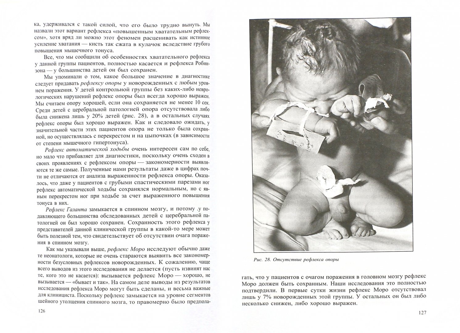 Иллюстрация 1 из 7 для Неврология новорожденных: острый период и поздние осложнения - Александр Ратнер | Лабиринт - книги. Источник: Лабиринт