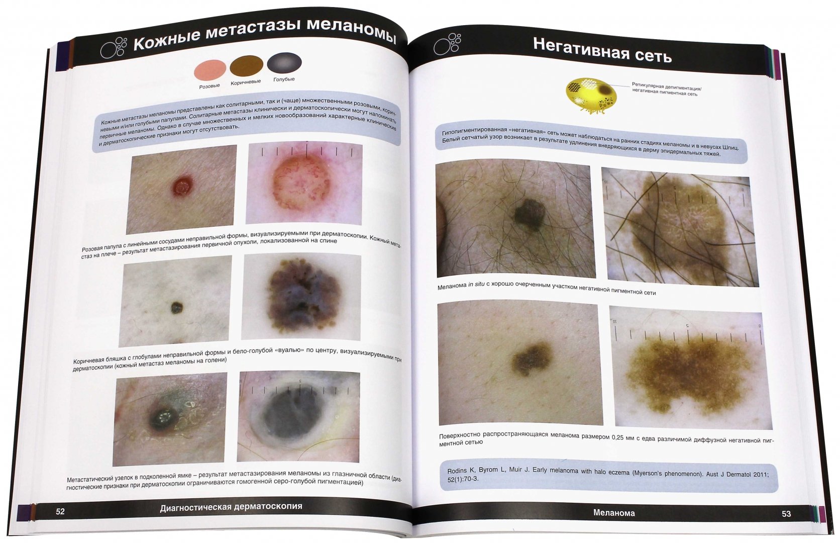 Иллюстрация 1 из 6 для Диагностическая дерматоскопия. Иллюстрированное руководство - Джонатан Боулинг | Лабиринт - книги. Источник: Лабиринт