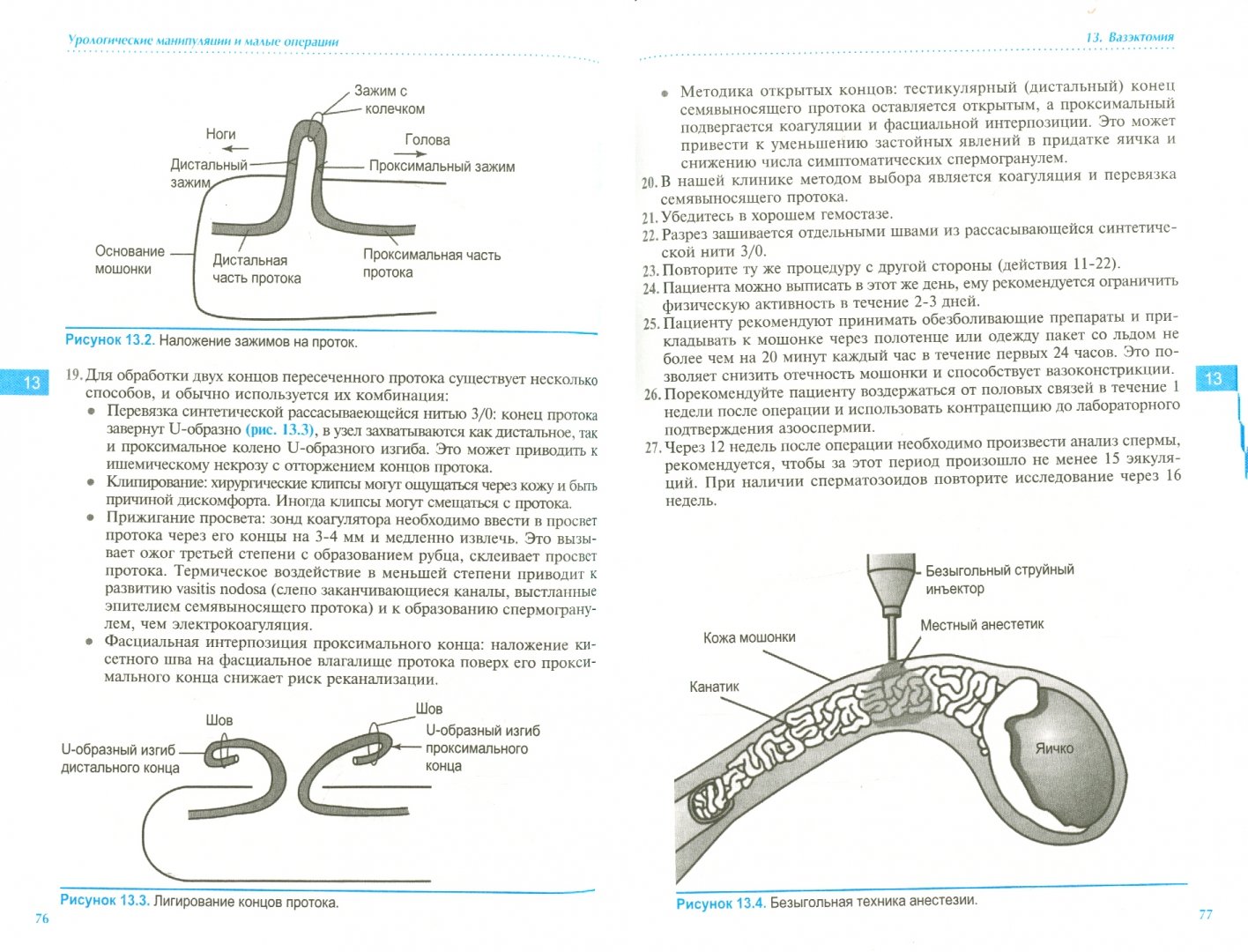 Иллюстрация 1 из 5 для Урологические манипуляции и малые операции - Хашим, Абрамс, Дмоховски | Лабиринт - книги. Источник: Лабиринт