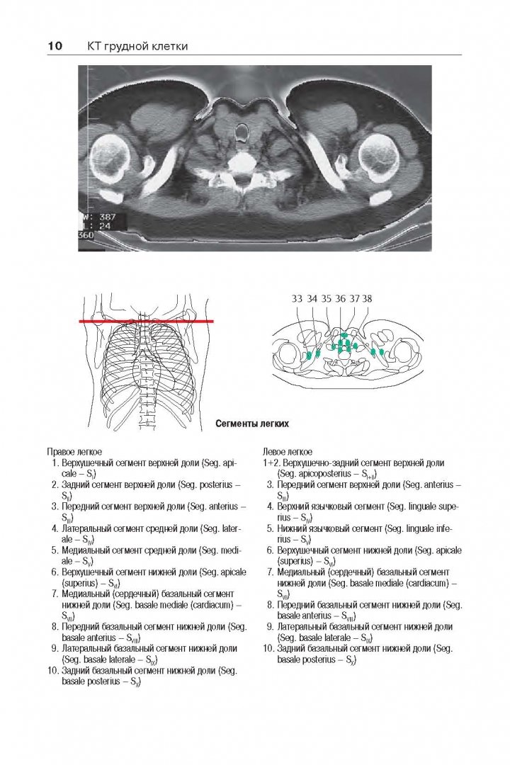 Иллюстрация 5 из 13 для Атлас секционной анатомии человека на примере КТ- и МРТ- срезов. В 3-х томах. Том 2 - Торстен Меллер | Лабиринт - книги. Источник: Лабиринт