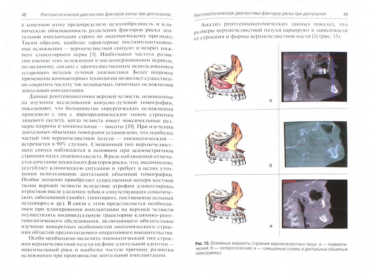 Иллюстрация 1 из 4 для Конусно-лучевая томография в дентальной имплантологии - Наталья Нечаева | Лабиринт - книги. Источник: Лабиринт