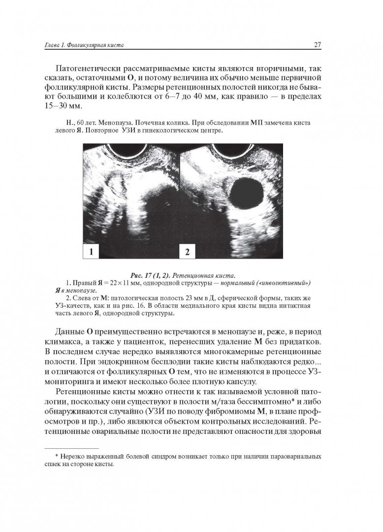 Иллюстрация 16 из 22 для Ультразвуковая симптоматика и дифференциальная диагностика кист и опухолей яичников - Сурен Хачкурузов | Лабиринт - книги. Источник: Лабиринт