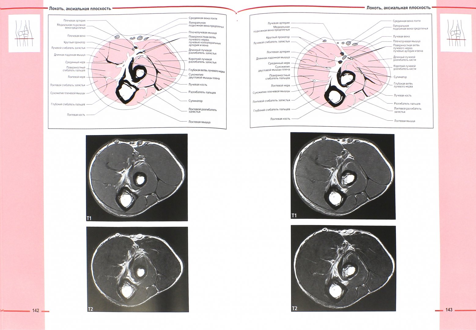 Иллюстрация 1 из 15 для МРТ костно-мышечной системы. Атлас - Роен, Лютьен-Дреколл, Хойк, Стайнборн | Лабиринт - книги. Источник: Лабиринт