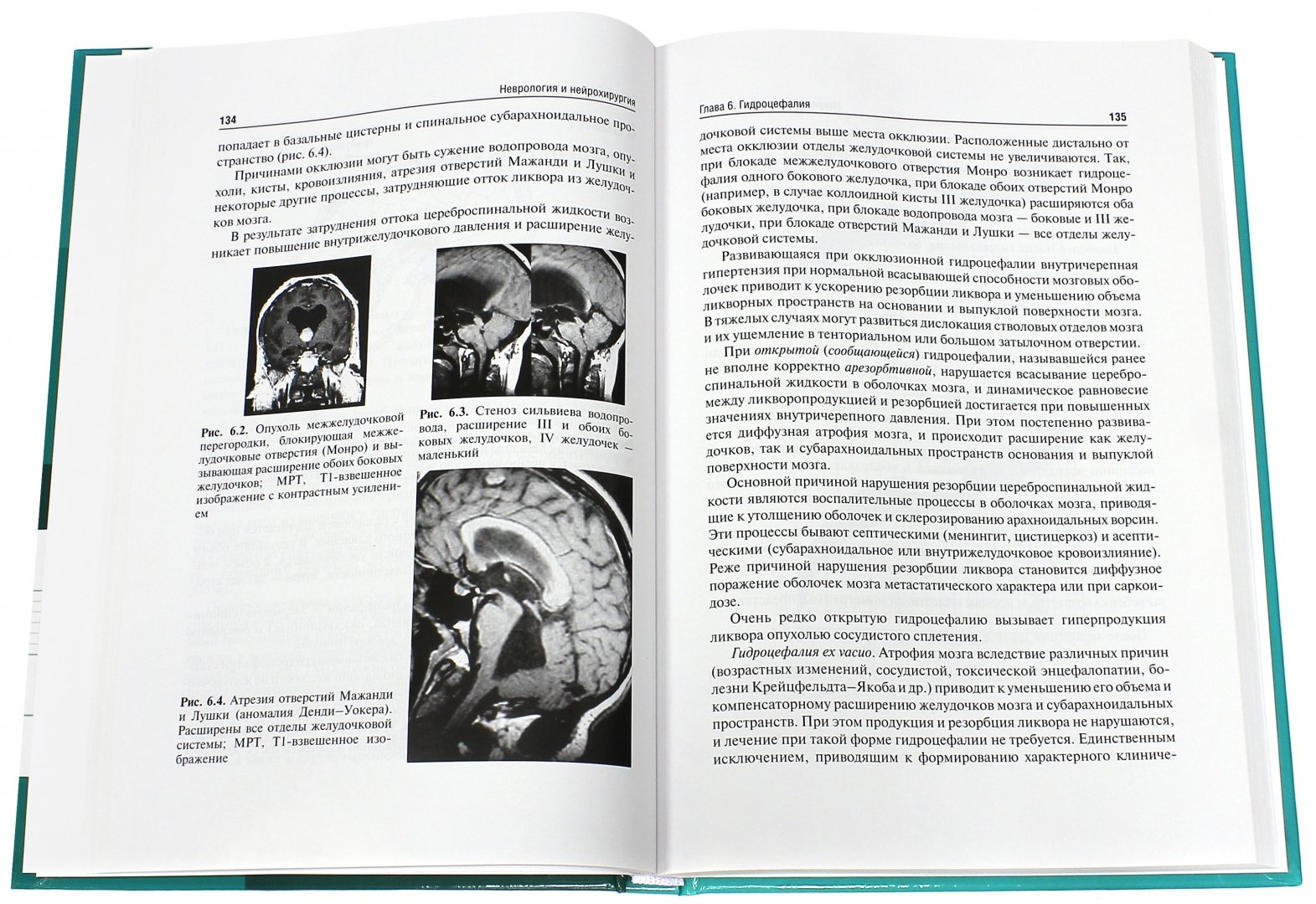 Иллюстрация 1 из 6 для Неврология и нейрохирургия. Учебник. В 2-х томах. Том 2. Нейрохирургия - Гусев, Коновалов, Скворцова | Лабиринт - книги. Источник: Лабиринт