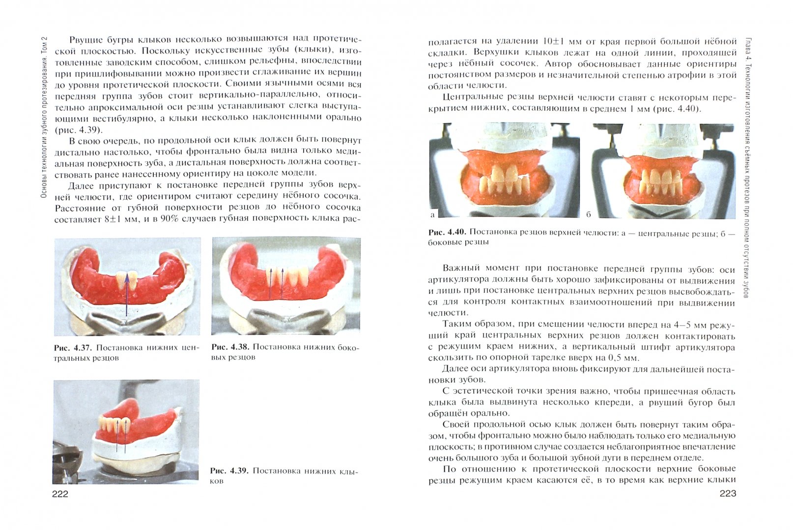Иллюстрация 1 из 11 для Основы технологии зубного протезирования. Учебник в 2-х томах. Том 2 - Каливраджиян, Брагин, Бурлуцкая | Лабиринт - книги. Источник: Лабиринт