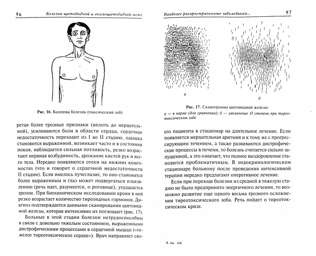 Иллюстрация 1 из 10 для Болезни щитовидной и околощитовидной желез: диагностика, профилактика, лечение - Виктор Казьмин | Лабиринт - книги. Источник: Лабиринт