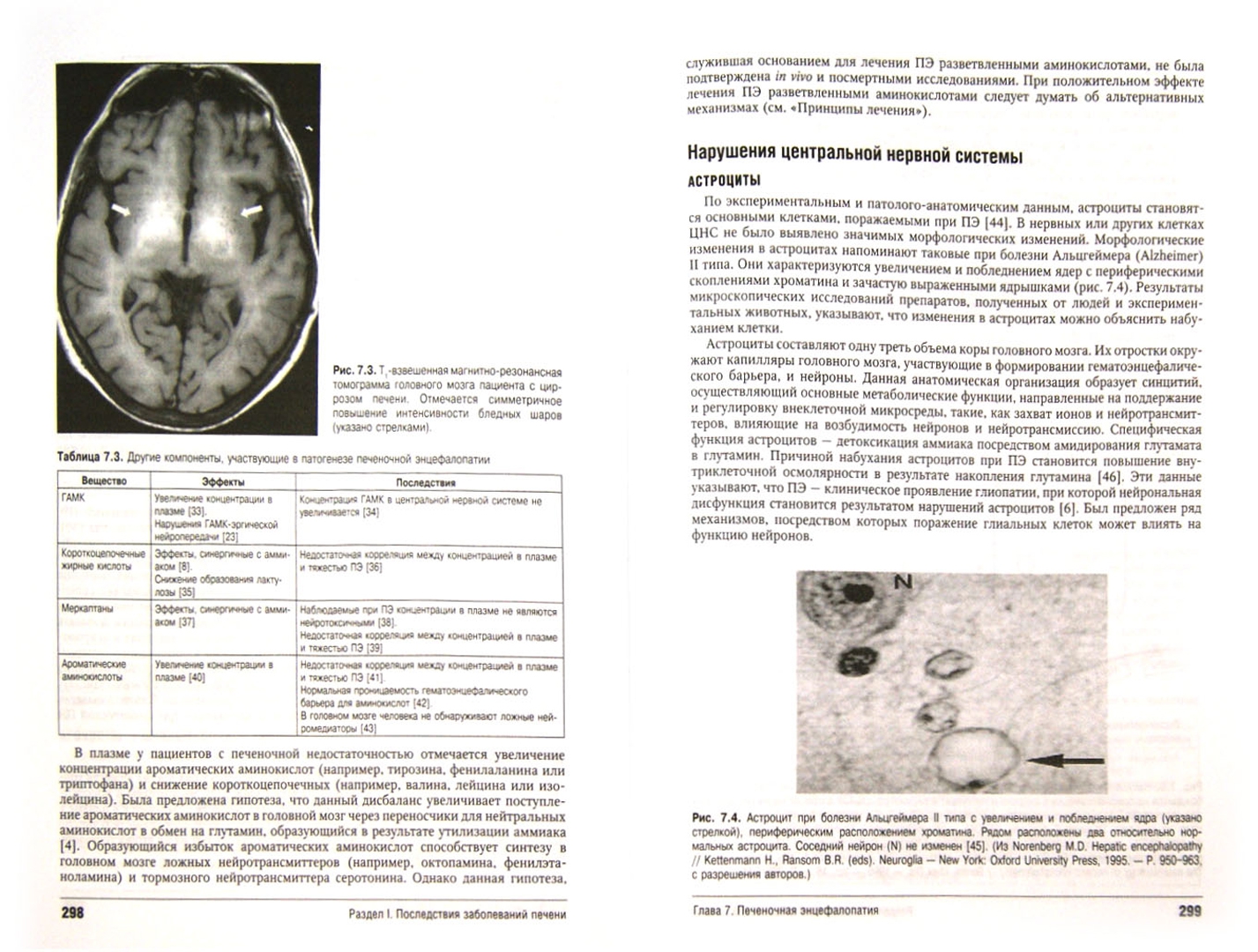 Иллюстрация 1 из 7 для Цирроз печени и его осложнения. Трансплантация печени - Шифф, Соррел, Мэддрей | Лабиринт - книги. Источник: Лабиринт