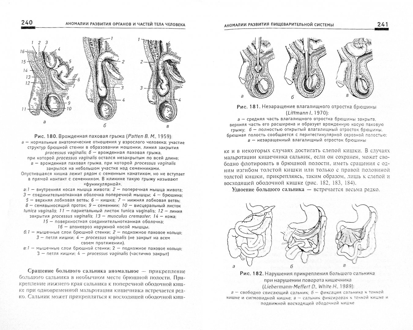 Иллюстрация 1 из 10 для Аномалии развития органов и частей тела человека. Учебное пособие - Калмин, Калмина | Лабиринт - книги. Источник: Лабиринт