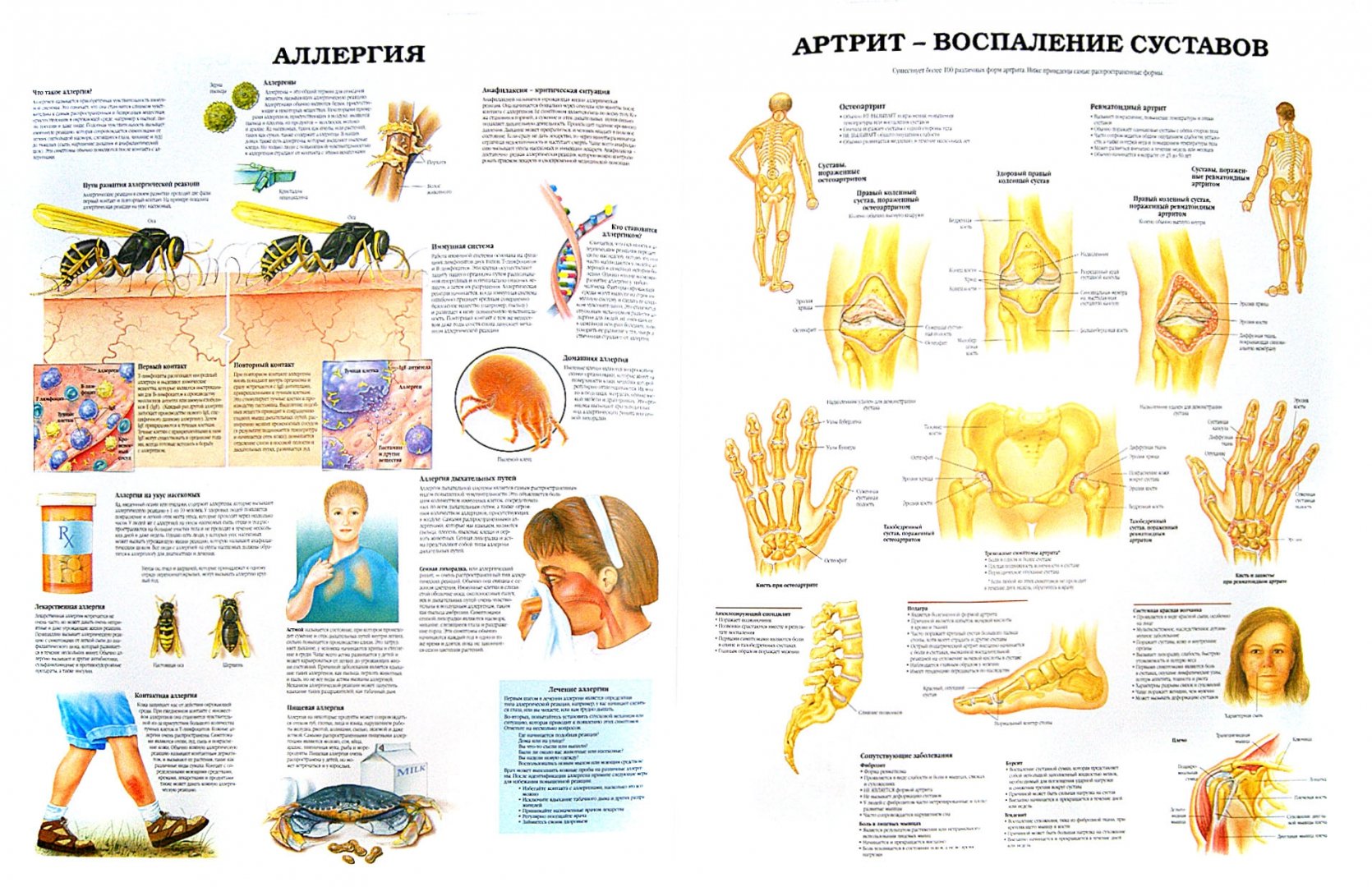 Иллюстрация 1 из 6 для Анатомия человека. Болезни и нарушения | Лабиринт - книги. Источник: Лабиринт